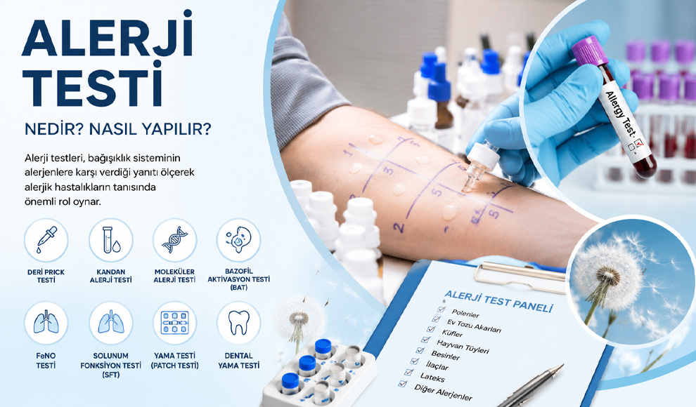 Alerji Testi