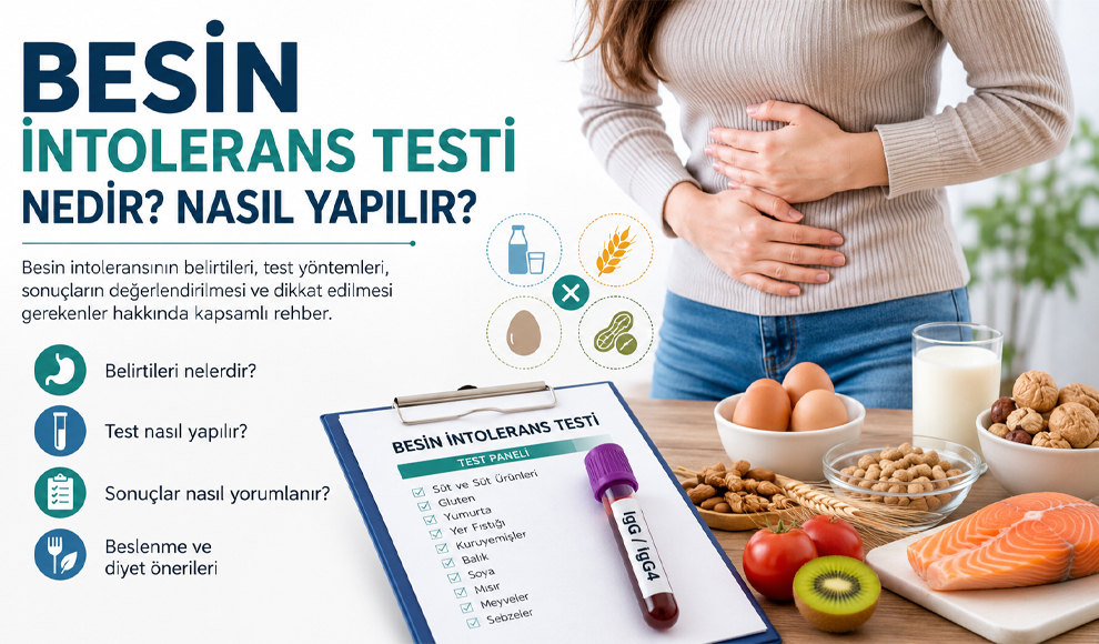 Besin İntolerans Testi