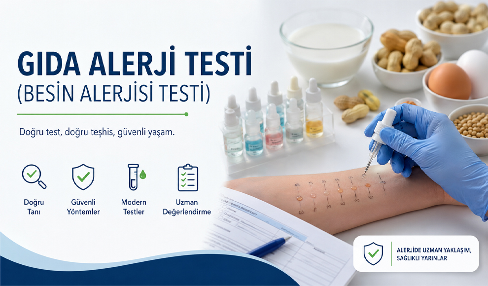 Gıda Alerji Testi (Besin Alerjisi Testi)