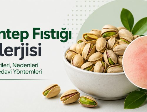 Antep Fıstığı Alerjisi