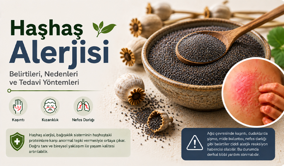 Haşhaş Alerjisi Haşhaş Alerjisi