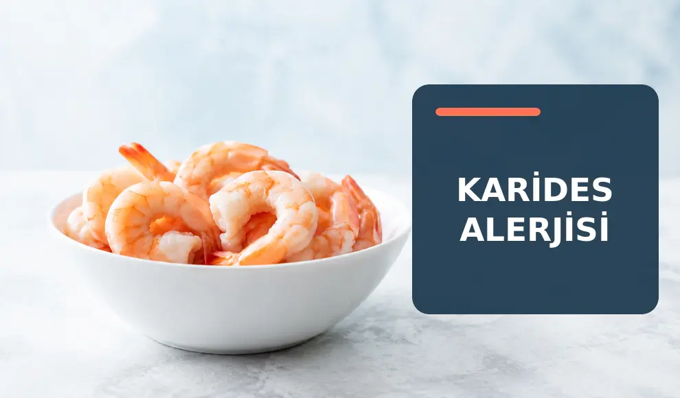 Karides Alerjisi Karides Alerjisi
