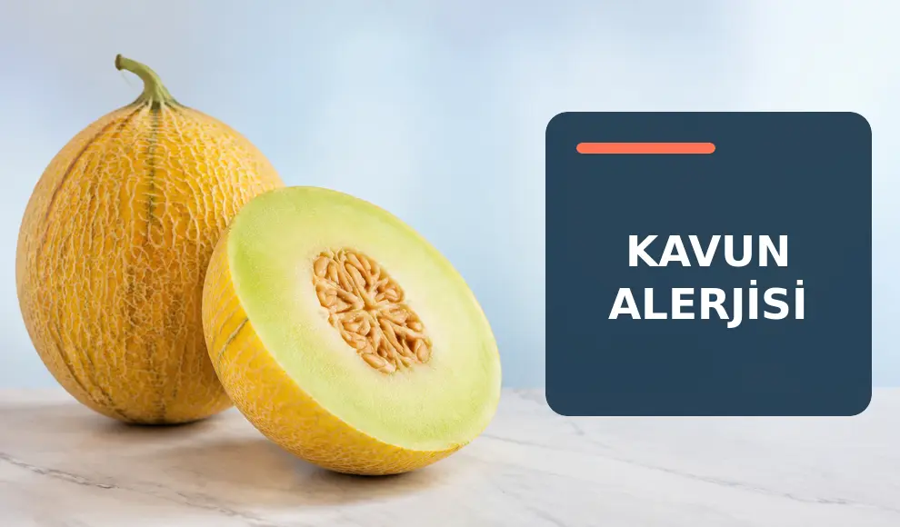 Kavun Alerjisi Kavun Alerjisi