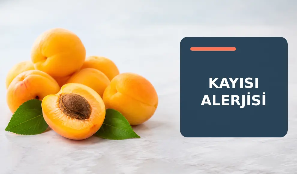 Kayısı Alerjisi Kayısı Alerjisi
