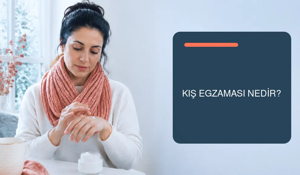 Kış Egzaması Nedir?