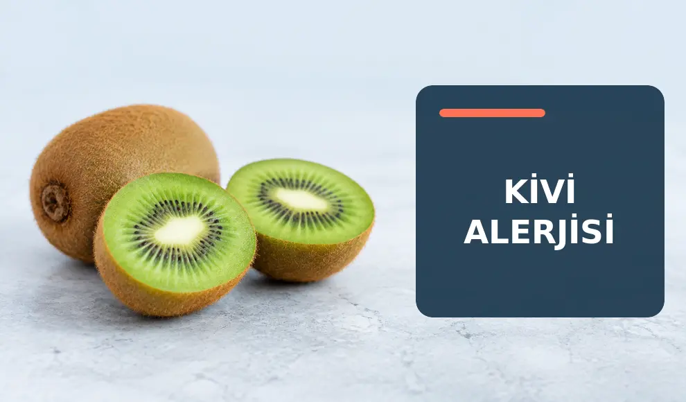 Kivi Alerjisi Kivi Alerjisi