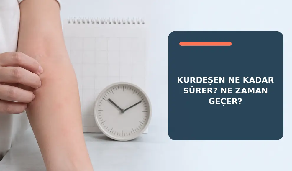 Kurdeşen Ne Kadar Sürer? Ne Zaman Geçer?