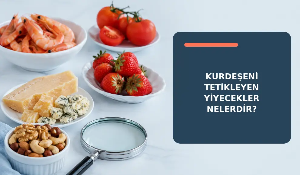 Kurdeşeni Tetikleyen Yiyecekler Nelerdir?