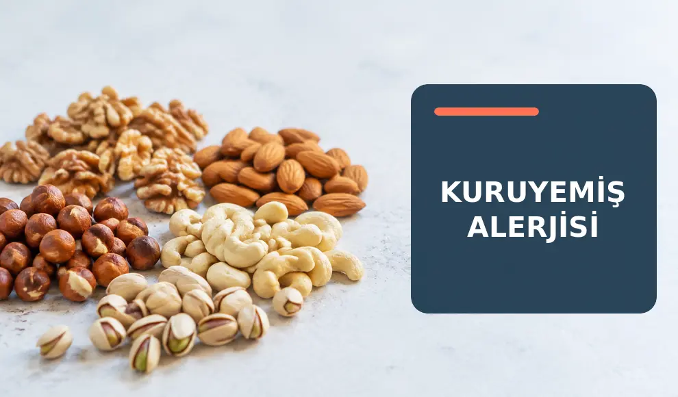 Kuruyemiş Alerjisi