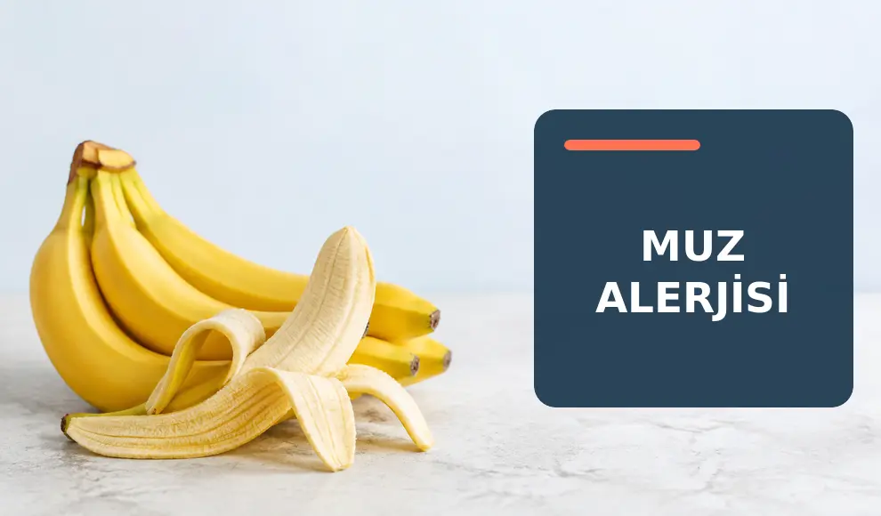 Muz Alerjisi