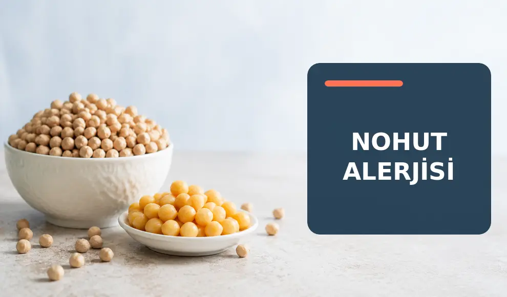 Nohut Alerjisi