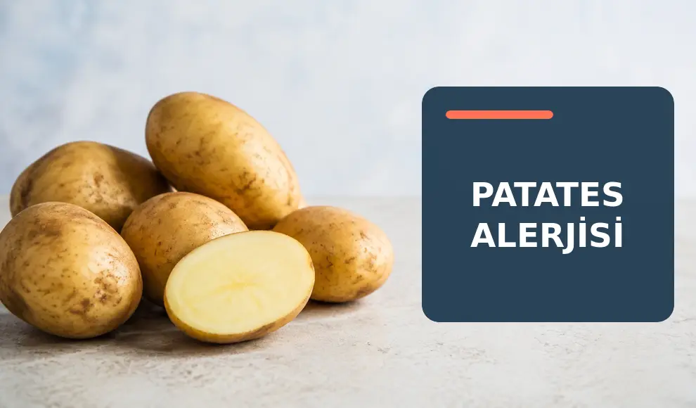 Patates Alerjisi