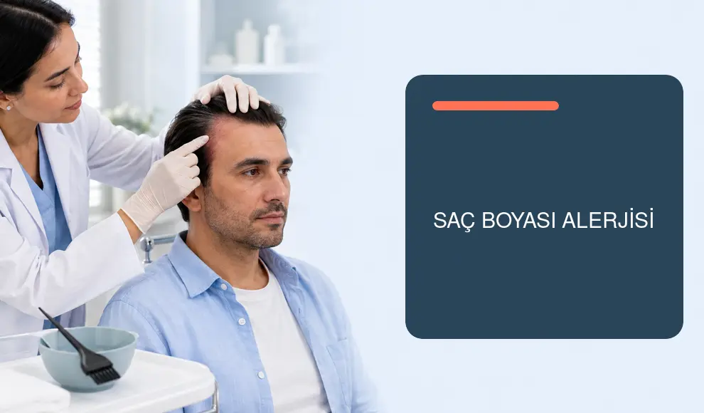 Saç Boyası Alerjisi