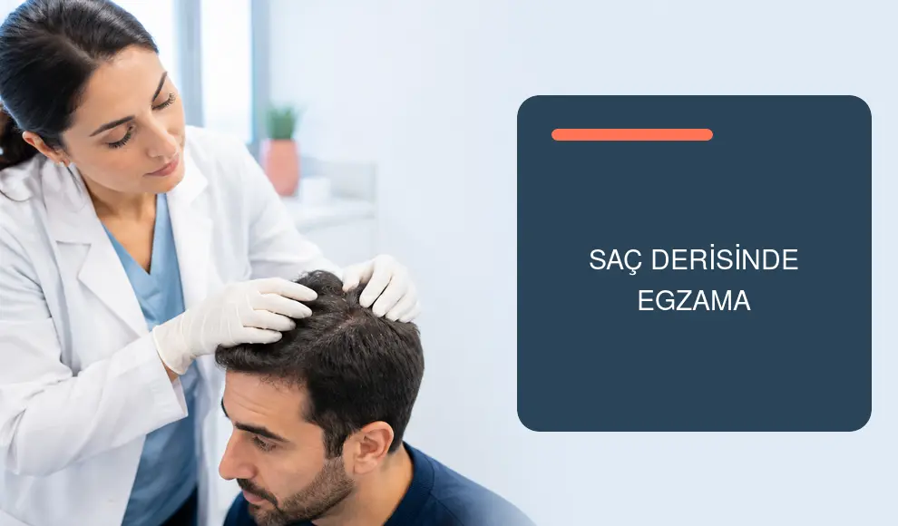 Saç Derisinde Egzama