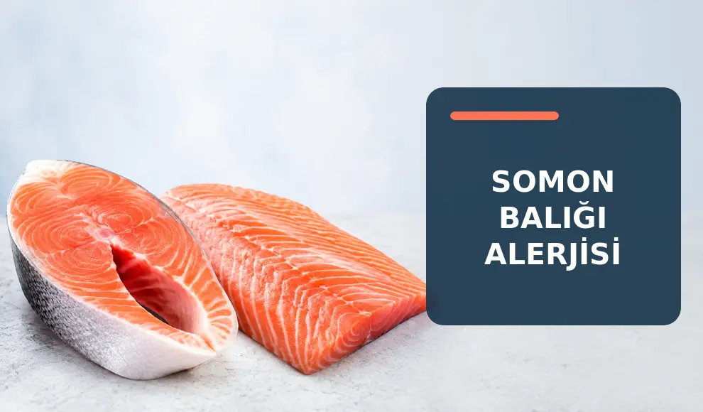 Somon Balığı Alerjisi