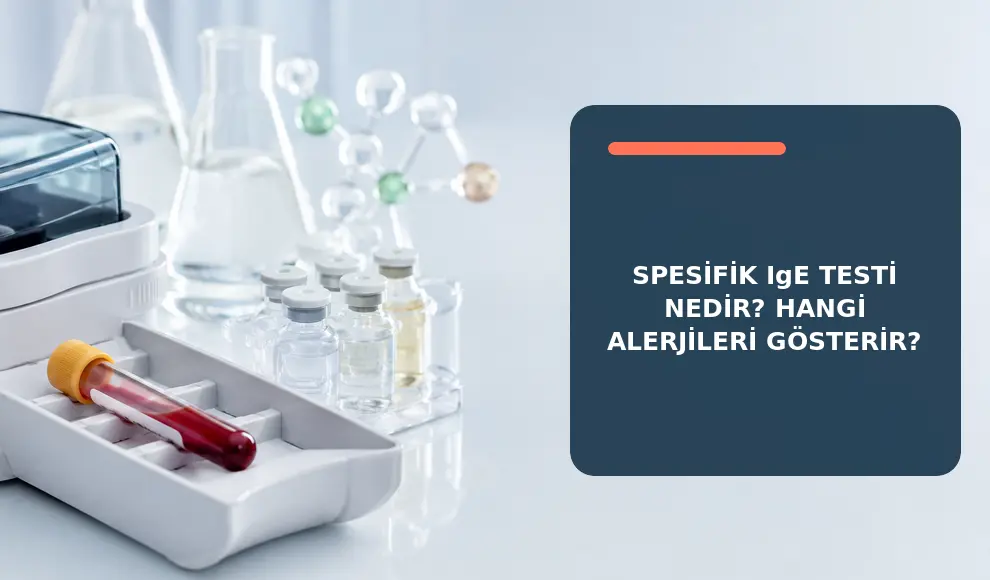 Spesifik IgE Testi Nedir? Hangi Alerjileri Gösterir?