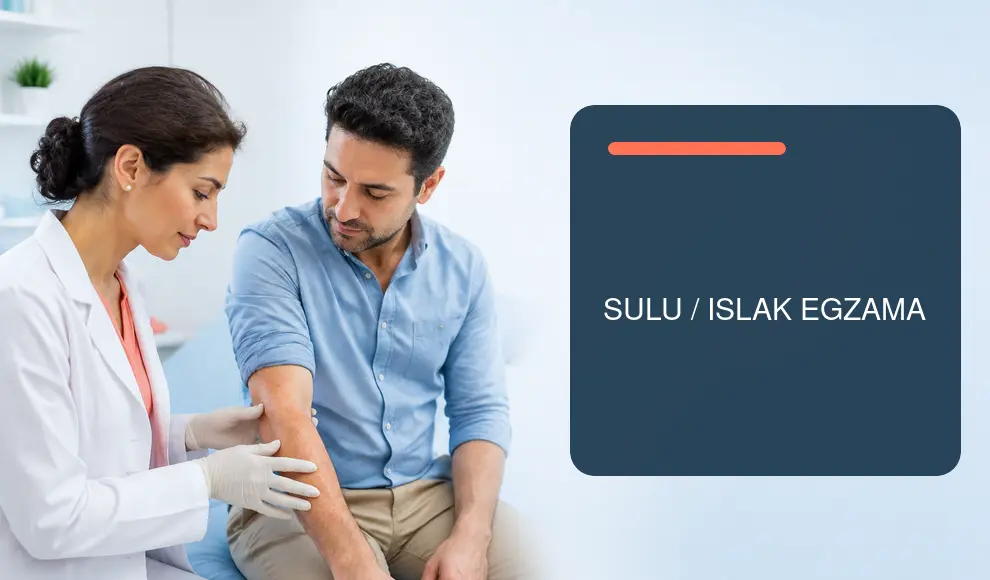 Sulu / Islak Egzama