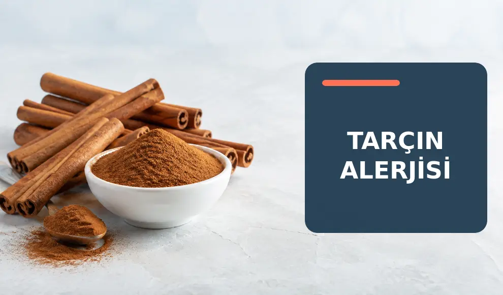 Tarçın Alerjisi