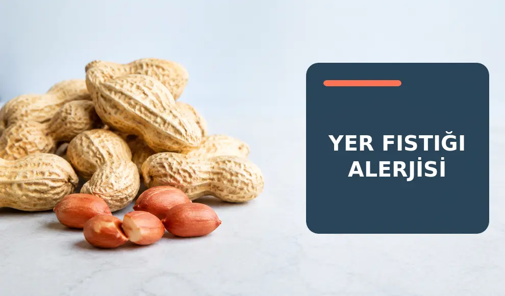 Yer Fıstığı Alerjisi